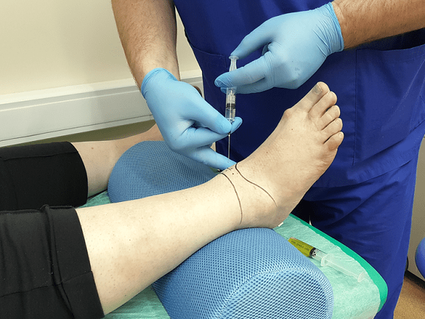 kupiti uređaje za liječenje artroze bol u zglobu kuka od ravnih stopala