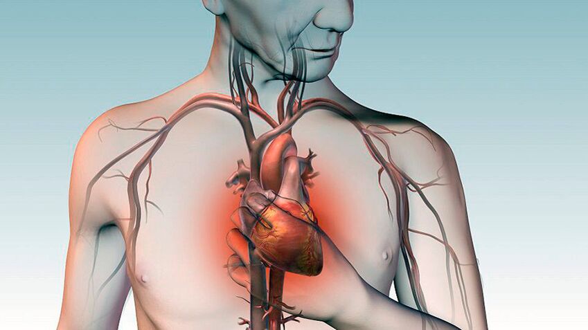 Bolovi ispod lopatice i pritiskajući bolovi iza prsne kosti s bolestima srca
