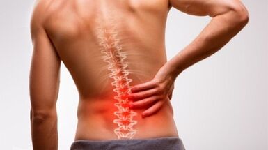 Znakovi i simptomi osteohondroze lumbalne kralježnice